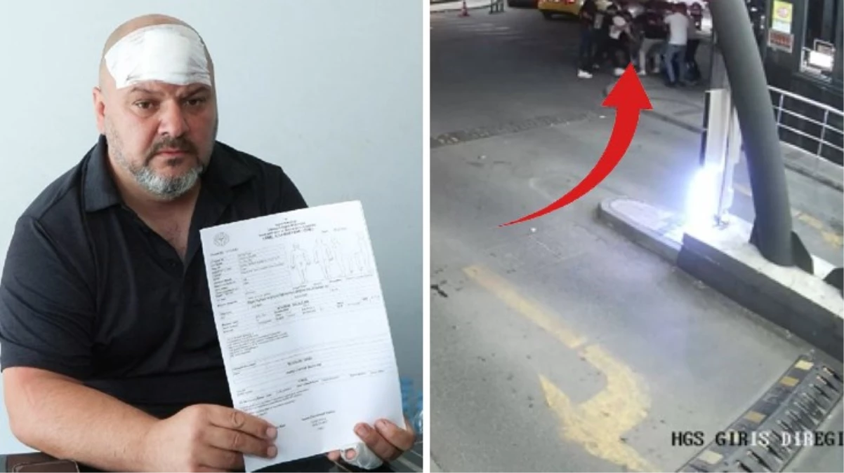 Toplanıp 70 bin liralık kira artışını kabul etmeyen ev sahibini öldüresiye dövdüler