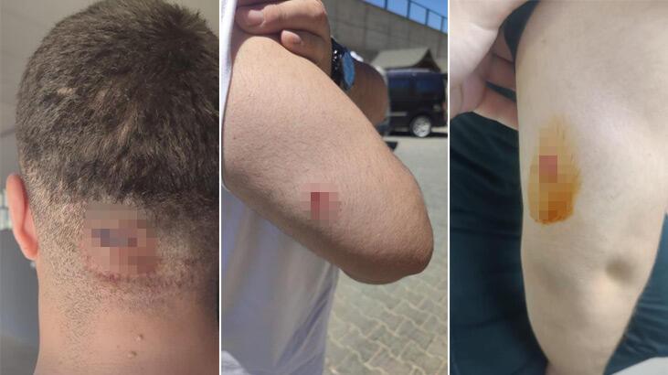 Betonun sıkıştırılmasını isteyen mühendislere saldırı