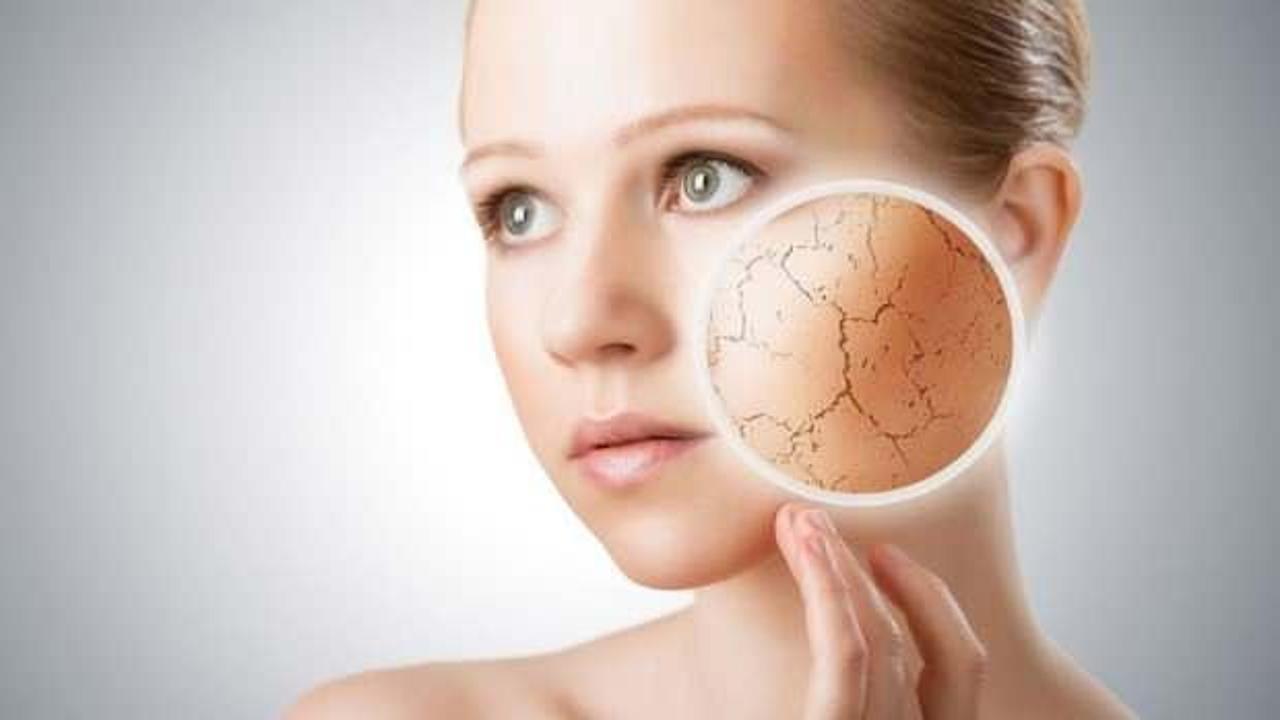Cilt kuruluğu hangi vitamin eksikliğinden, neden olur? Cilt kuruluğu belirtileri…