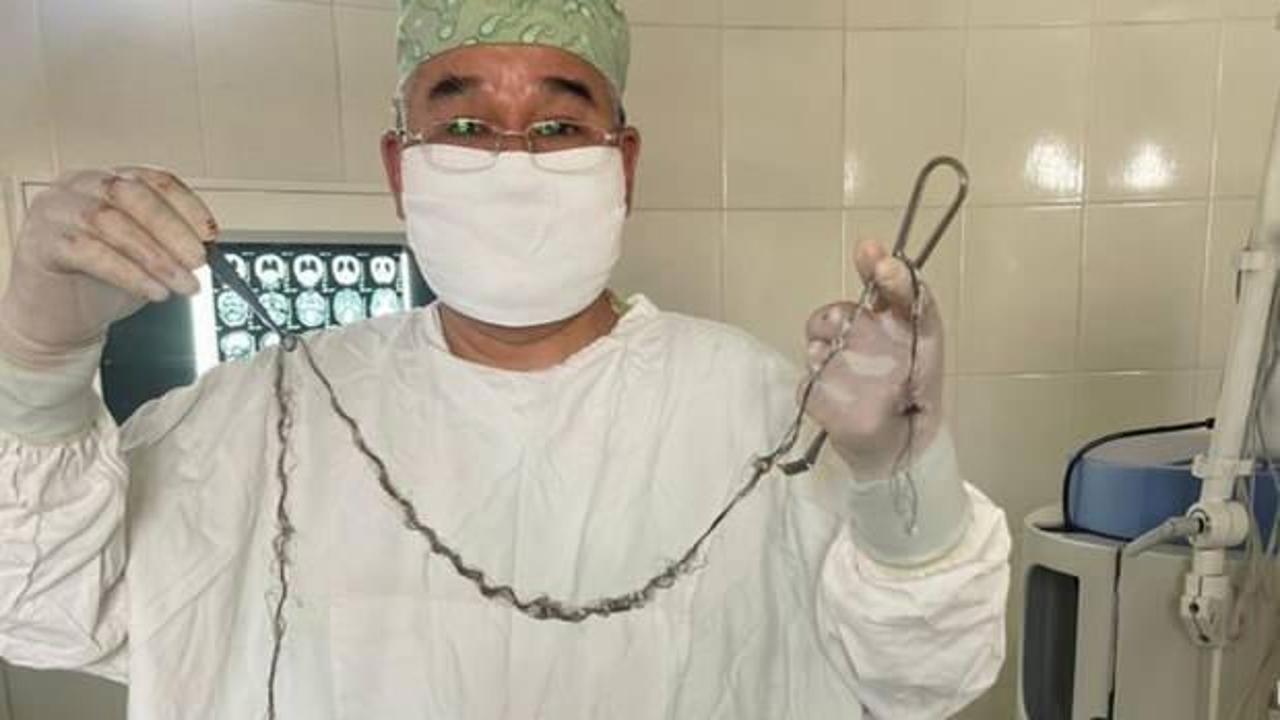 Hastanede akıllara durgunluk veren olay! Kırgızistanlı çocuğun beyninden saç çıktı