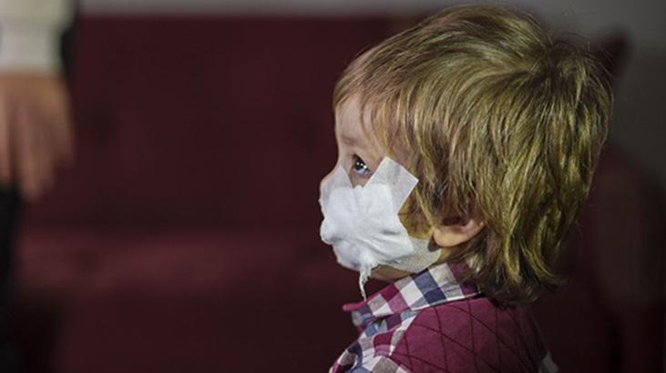 Pitbull Dehşetinden Kurtulan 1,5 Yaşındaki Efe Taburcu Edildi